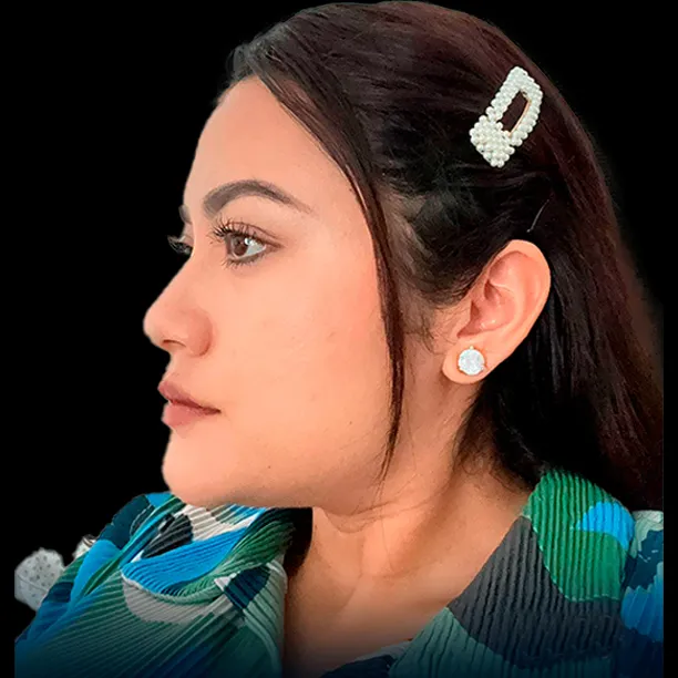 Resultado Dental - Antes