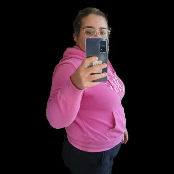 Resultado Cirugía Bariátrica - Antes