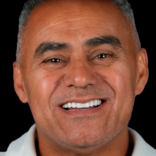 Resultado Cirugía Ocular - Antes