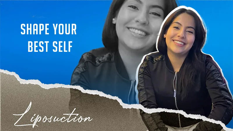 Experiencia Liposucción Turquía