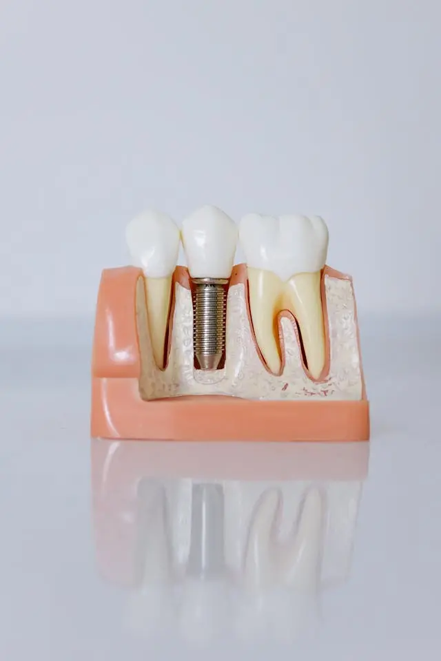 Implantes Dentales en Turquía - Clínica Zenova