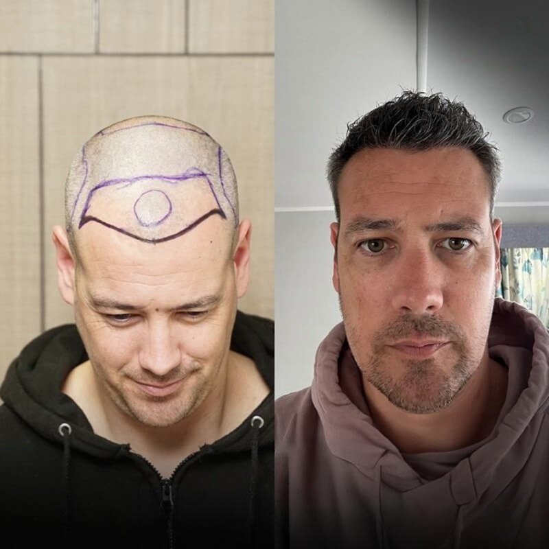 Comparación antes y después del caso 3